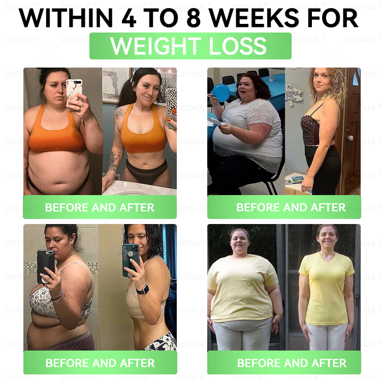 2026 New & Upgraded: 90% OFF ✅ 𝑫𝑶𝑻𝑨𝑳𝑬® Lymphatic Drainage Slimming Nano-Microneedle Patch: Ultra-Potent 5× Formula with Lipolytic Peptide Complex — Supports Weight Loss & Lymphatic Flow — Plus Joint Relief, Better Sleep & Mental Clarity