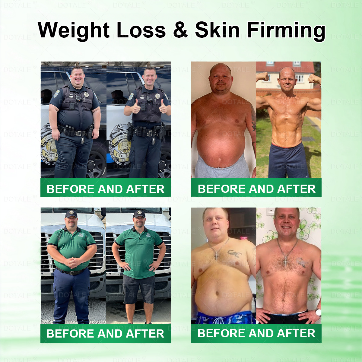 2026 New & Upgraded: 90% OFF ✅ 𝑫𝑶𝑻𝑨𝑳𝑬® Lymphatic Drainage Slimming Nano-Microneedle Patch: Ultra-Potent 5× Formula with Lipolytic Peptide Complex — Supports Weight Loss & Lymphatic Flow — Plus Joint Relief, Better Sleep & Mental Clarity