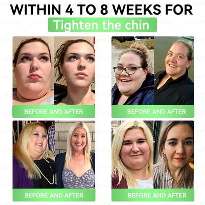 2026 New & Upgraded: 90% OFF ✅ 𝑫𝑶𝑻𝑨𝑳𝑬® Lymphatic Drainage Slimming Nano-Microneedle Patch: Ultra-Potent 5× Formula with Lipolytic Peptide Complex — Supports Weight Loss & Lymphatic Flow — Plus Joint Relief, Better Sleep & Mental Clarity